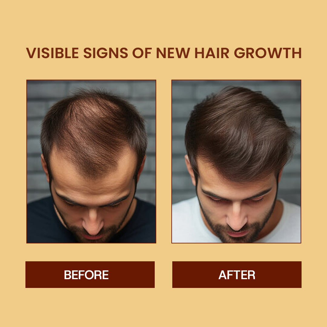 Customised Advanced Homeopathy Hair Care Kit