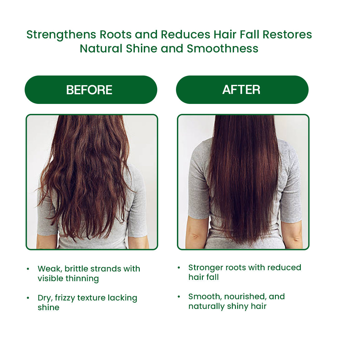 Scalpocare Shampoo With Arnica Montana  – 2 in 1 Shampoo + Conditioner (125ml)  FREE Derma Roller