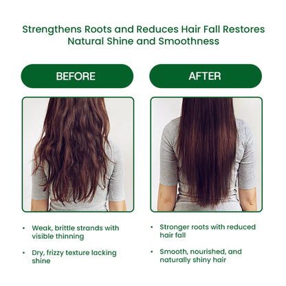 Scalpocare Shampoo With Arnica Montana  – 2 in 1 Shampoo + Conditioner (125ml)  FREE Derma Roller